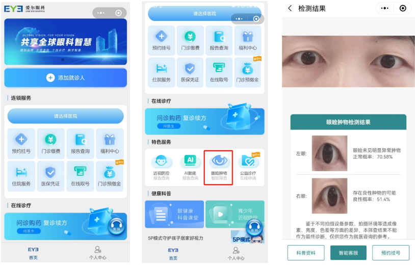 愛爾眼科互聯(lián)網(wǎng)醫(yī)院小程序“眼瞼腫物智能篩查”,。